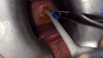 Extreme cervix play during gyno exam feels so intense and raw