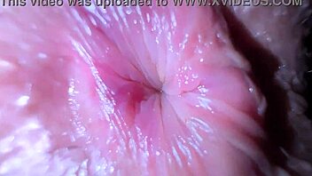 doctor licks asshole for temperature