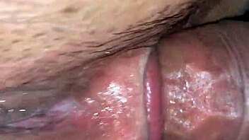 My sister-in-law calls for anal relief