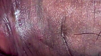 My sister-in-law calls for anal relief