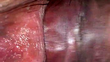 My sister-in-law calls for anal relief