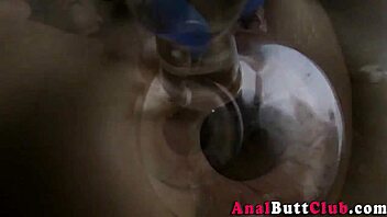A girl with a big ass prolapsus, experiencing unpleasant sensations