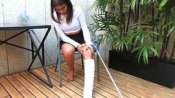 asian amateur in car accident with leg cast