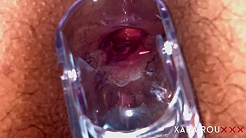 i love gaping my fat ass with speculum wide open