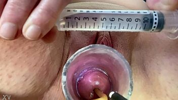 feel that extreme catheter balloon inflating cervix wildly