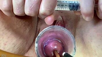 feel that extreme catheter balloon inflating cervix wildly